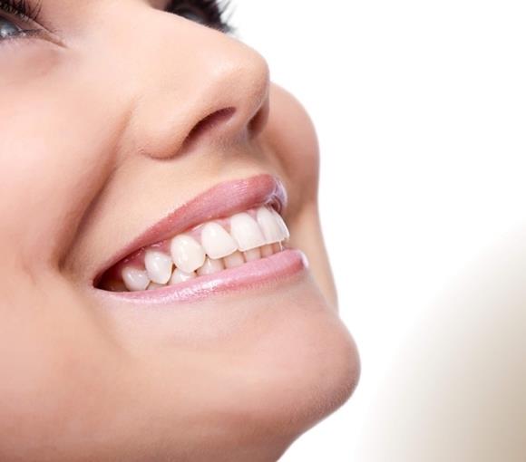 Clareamento Dental